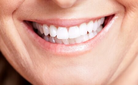 הרמת סינוס בשיטת IRaise : יותר מהר ופחות כואב בדרך להשתלת שיניים
