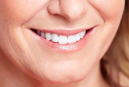 השתלת שיניים דיגיטלית: ללא חתכים או תפרים מיותרים