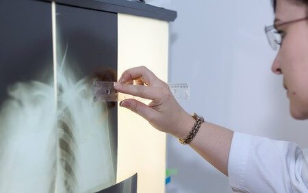צילום רנטגן CT