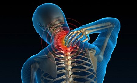 קיבוע צווארי: כל המידע על ניתוחי עמוד השידרה הצווארי