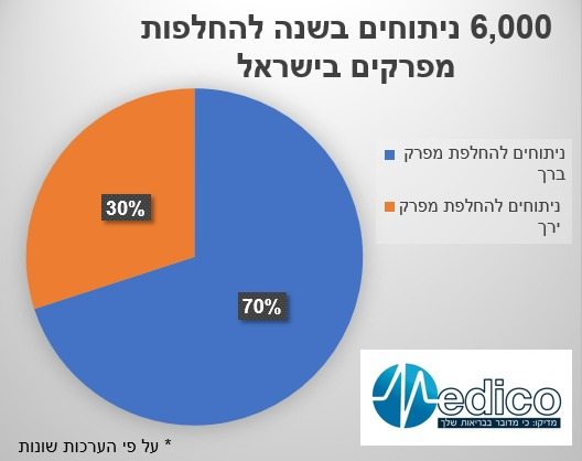 נתונים החלפות מפרקים בישראל