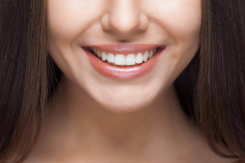 הטיפול החדשני לשיפור מראה השיניים באמצעות ציפויי חרסינה