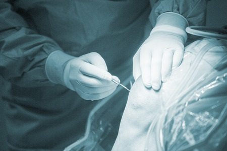 ניתוח ארתרוסקופיה של ברך: המדריך המלא