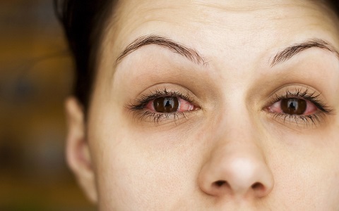 מחלות עיניים דלקתיות: זיהוי וטיפול
