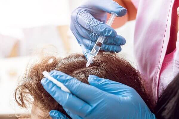 טיפול PRP להתקרחות ושיער דליל: שני טיפולים בלבד וללא תופעות לוואי