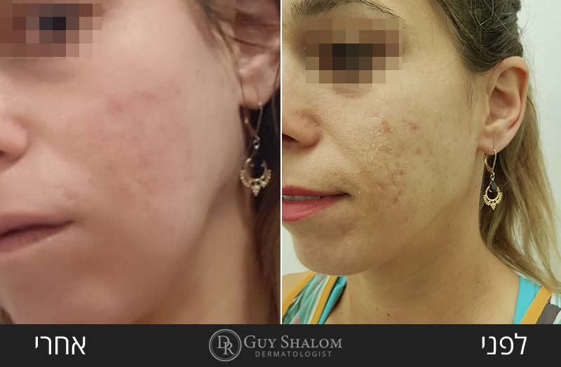 before-after-72.jpg