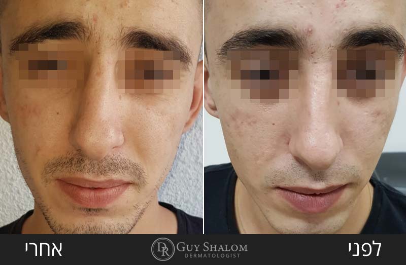 before-after-75.jpg