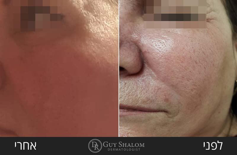 before-after-79.jpg