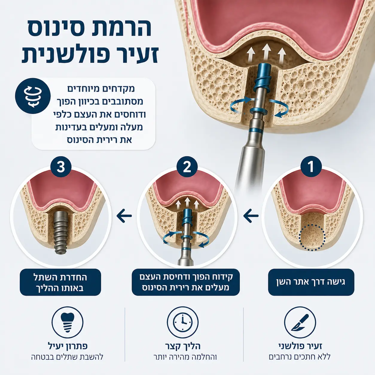 הרמת סינוס זעיר פולשנית | אינפוגרפיקה