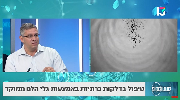 טיפול בדלקות כרוניות באמצעות גלי הלם ממוקד