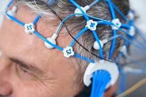 בדיקת EEG