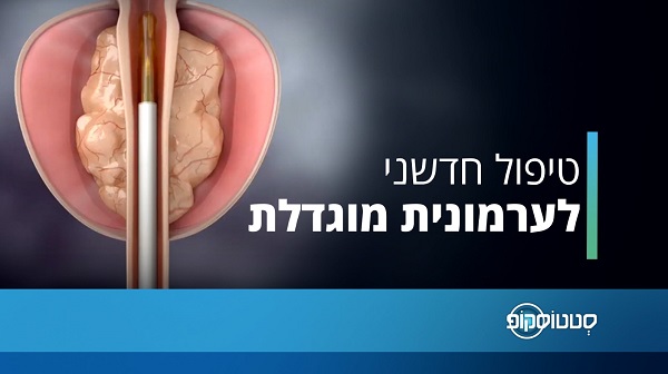 מצאנו את הפתרון היעיל לערמונית מוגדלת: שיטת Rezum במרכז הרפואי רמת אביב